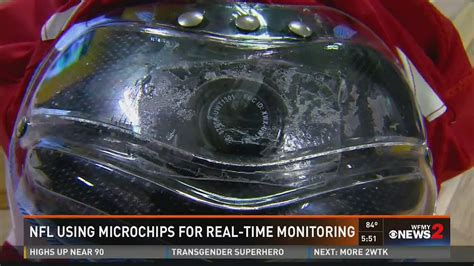 microchips in nfl